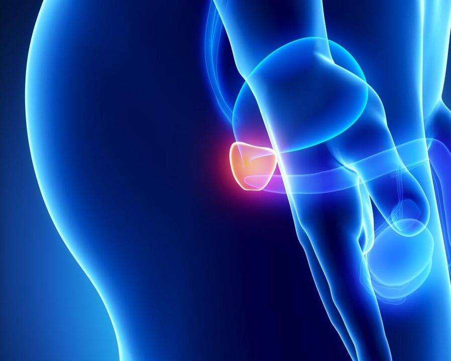 Entzündung der Prostata
